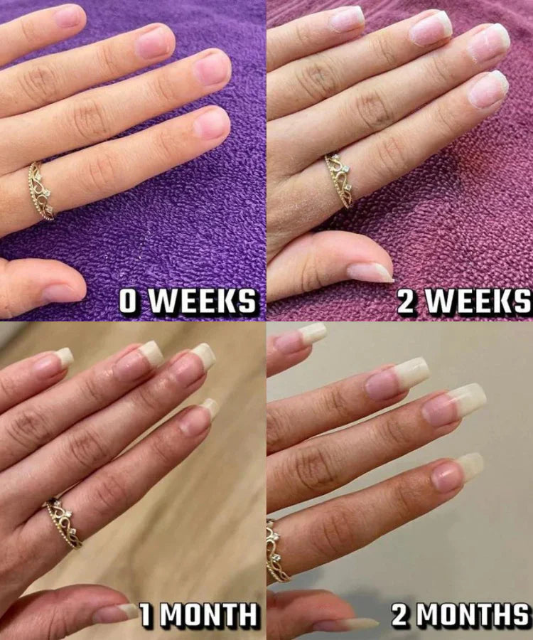 AriaLux Stem Cell Nail Growth Oil